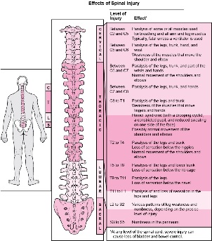 maladies dans le corps associées à des dommages à diverses parties de la colonne vertébrale