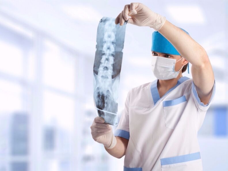 le médecin regarde un instantané de la colonne cervicale avec ostéochondrose