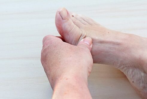 arthrose du pied