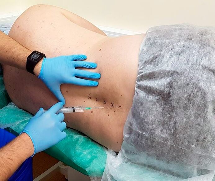 blocages médicinaux pour le dos